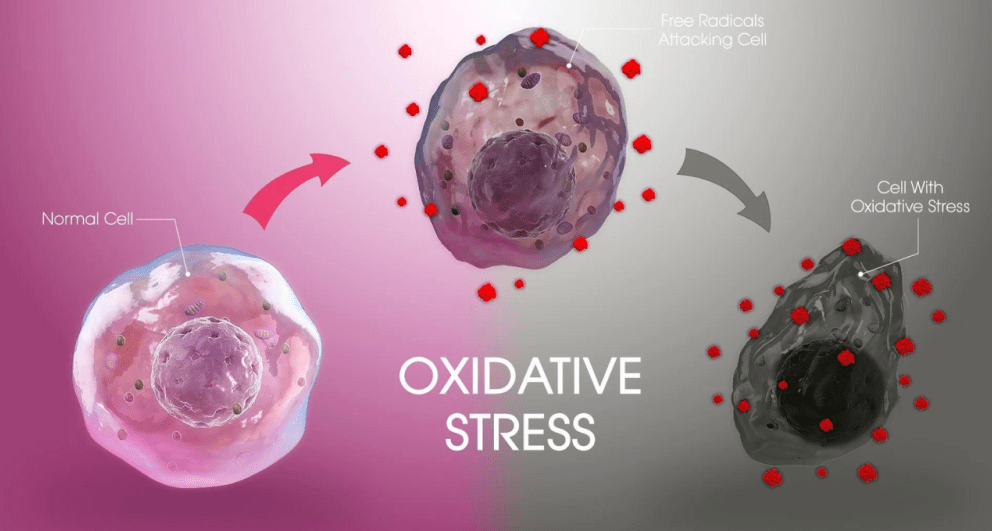 Oxidative Stress