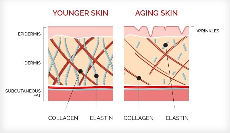 Declining Collagen Production